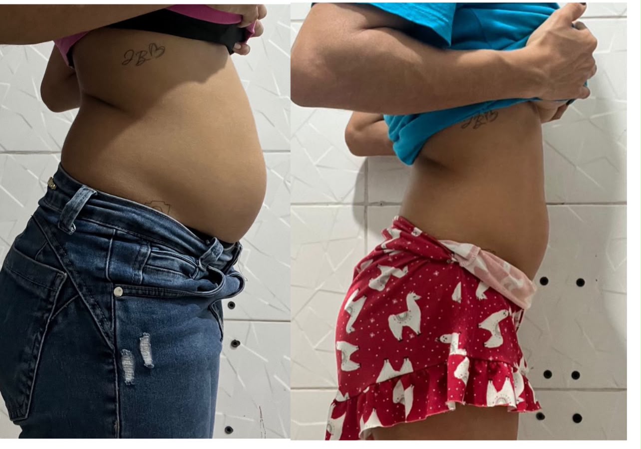 Resultado real de aluna do Método Queimax